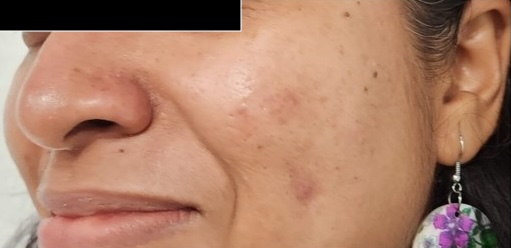 After — Skin Balance Gentle Cleanser
